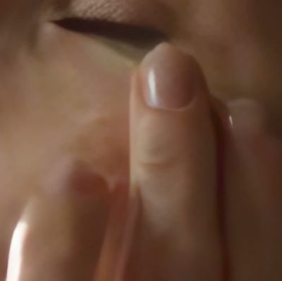 A close-up crop of a cheek and fingertips, with faint mottling across the skin