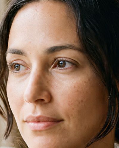 A close crop of the cheek and eye at medium strength, natural skin